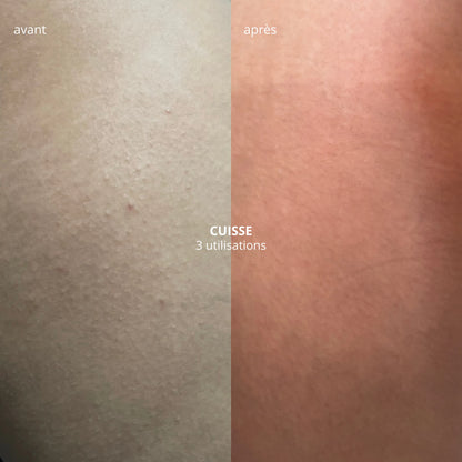 AvlynaBrosse® massage à sec - stimule la circulation & lisse la peau